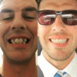 Smilefullness Ortodoncia Invisible Invisalign